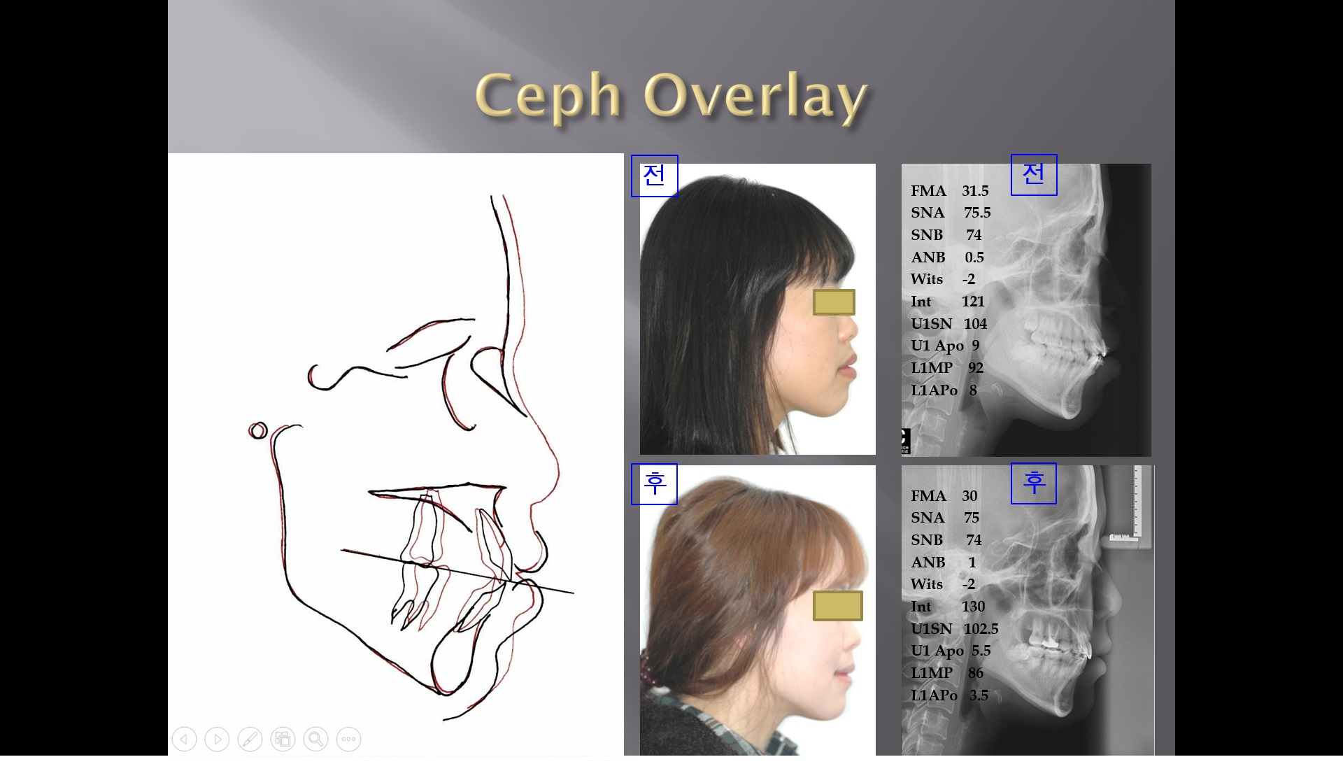 (강의 7) Sem #2 : Ceph Overlay