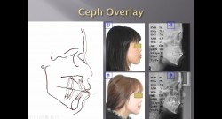 (강의 7) Sem #2 : Ceph Overlay