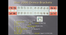 (강의 11) Sem #3 : Bracket, Band, Archwire (Part 1)