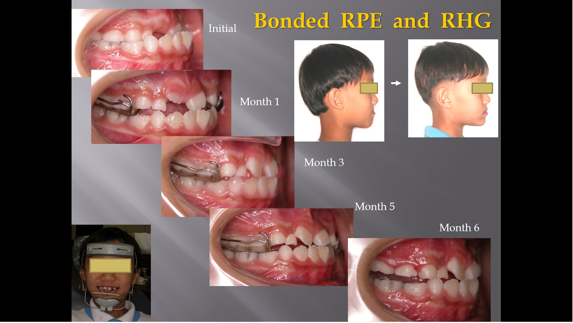 (강의 23) Sem #9 : Pedo-Ortho (Part 1)