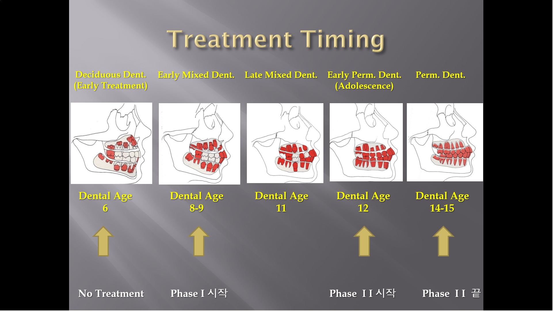 (강의 23) Sem #9 : Pedo-Ortho (Part 2)