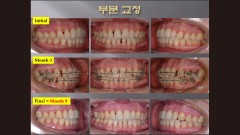 (강의 52) Sem #20.5 부분교정 강의 (Part 2)